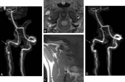 Fig 4.