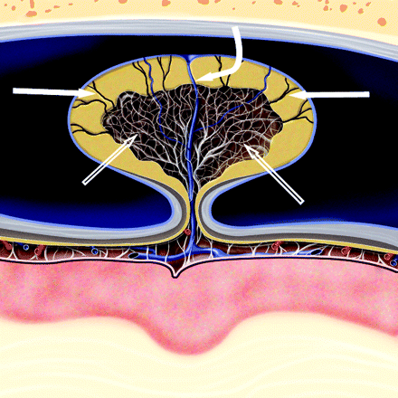 Fig 4.