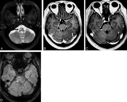 Fig 1.