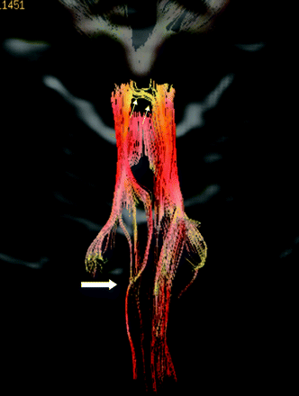 Fig 2.