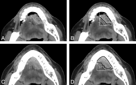Fig 2.