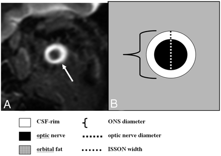 Fig 1.