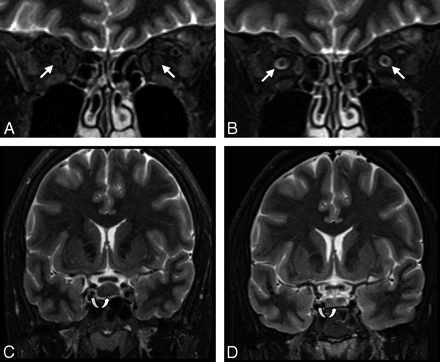 Fig 3.