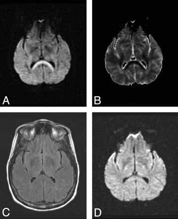 Fig 1.