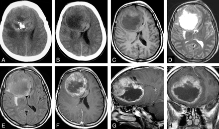 Fig 1.