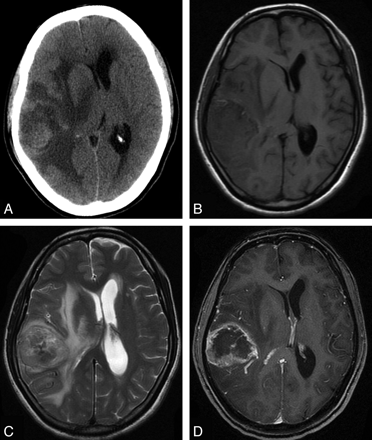 Fig 3.