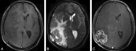 Fig 4.