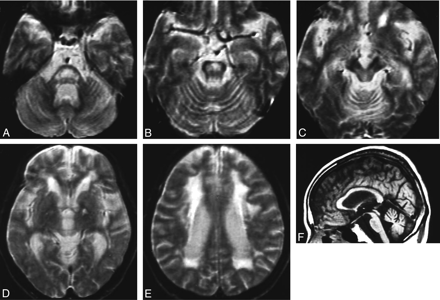 Fig 1.