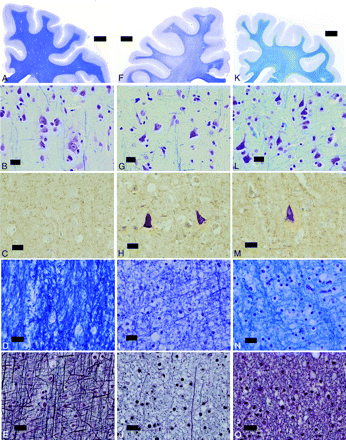 Fig 3.