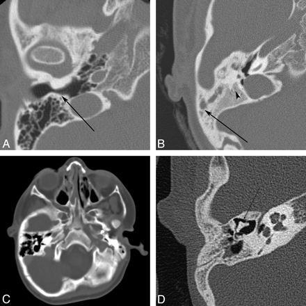 Fig 5.