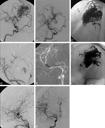 Fig 2.