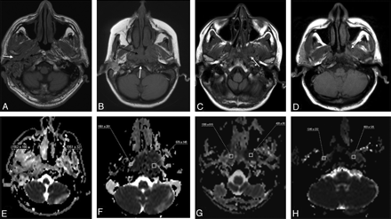 Fig 3.