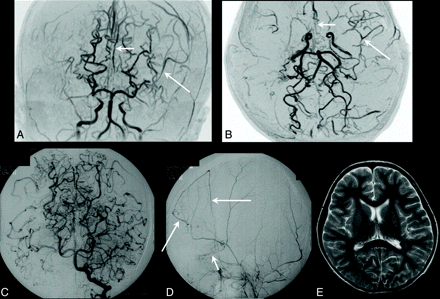 Fig 3.