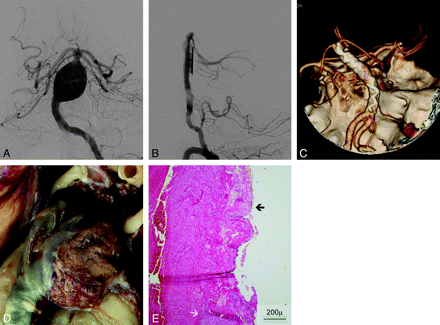 Fig 2.