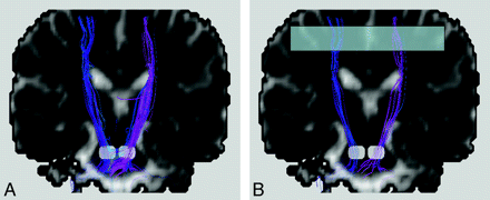 Fig 4.