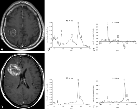 Fig 3.