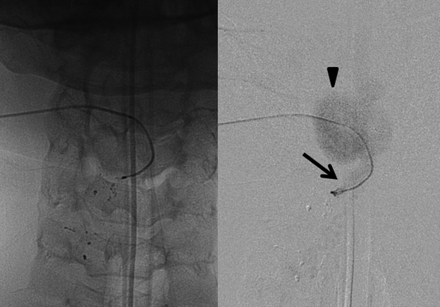 Fig 3.