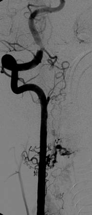 Fig 4.