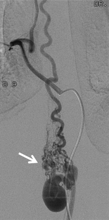 Fig 5.