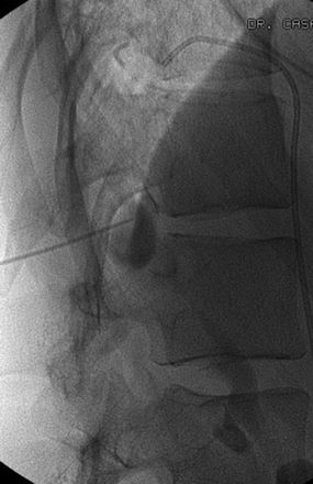 Fig 6.
