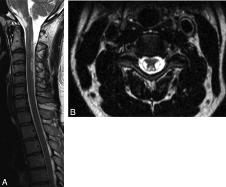 Fig 1.