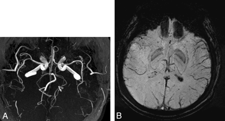 Fig 2.