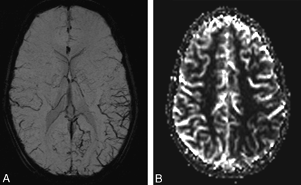 Fig 3.