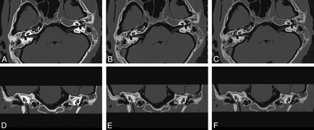 Fig 2.