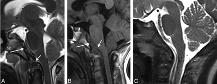 Fig 1.