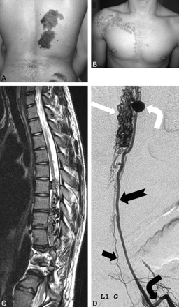 Fig 2.