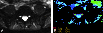 Fig 1.