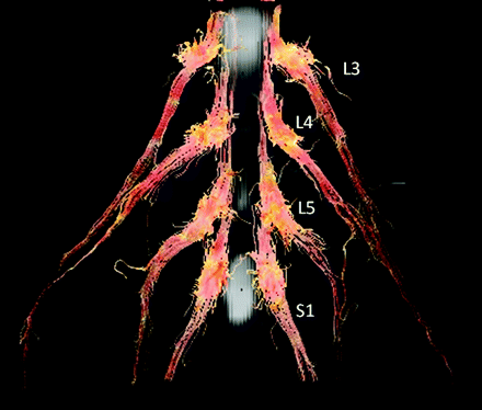 Fig 2.