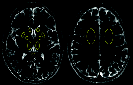 Fig 1.