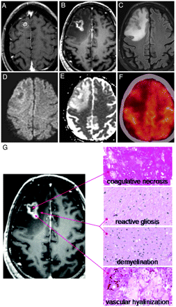 Fig 5.