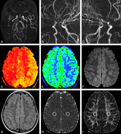 Fig 2.