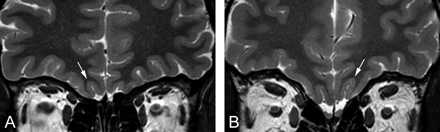 Fig 3.