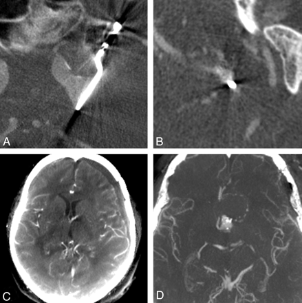 Fig 4.