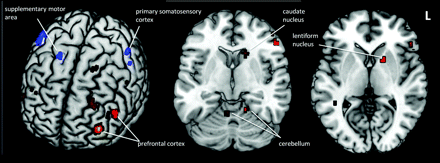 Fig 2.