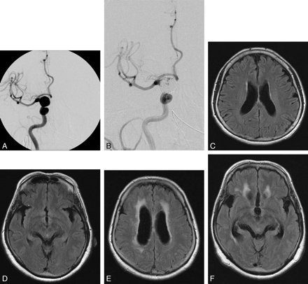Fig 1.