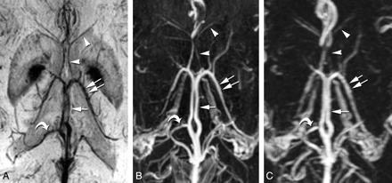 Fig 1.