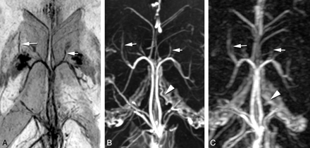 Fig 2.