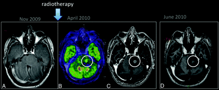 Fig 3.