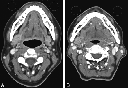 Fig 1.