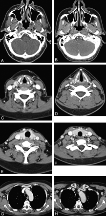 Fig 3.