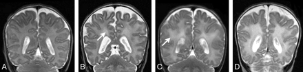 Fig 1.