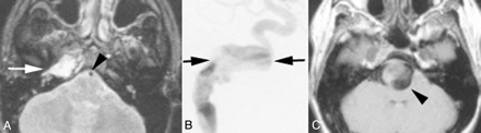 Fig 2.