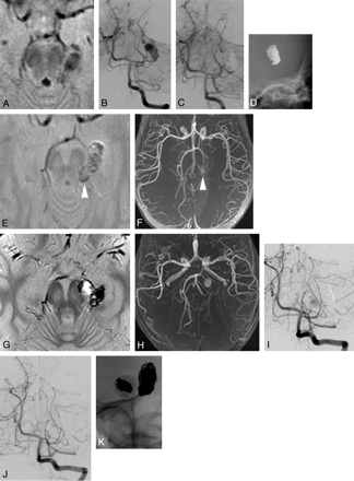 Fig 3.