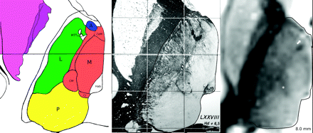 Fig 3.