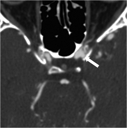 Fig 1.