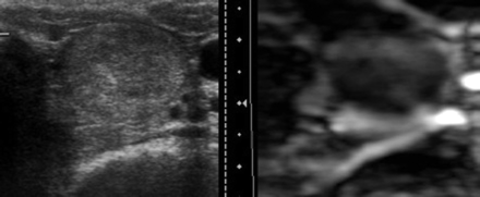 Fig 4.